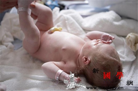 新生儿肚脐怎么护理_棉签-脐带-根部-肚脐- ()