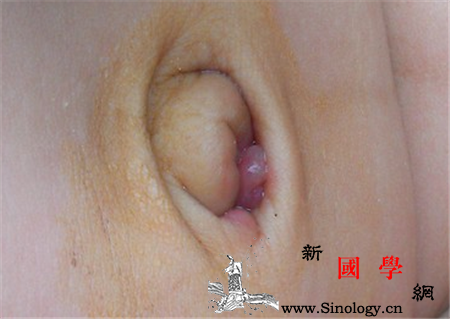 新生儿肚脐可以用碘伏消毒吗_紫药水-脐带-肚脐-消毒-
