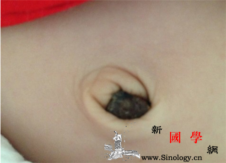 新生儿肚脐里面的黑色是什么_脐带-肚脐-纱布-消毒-