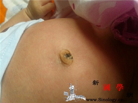 宝宝肚脐里的脏东西能抠吗_肚脐眼-肚脐-污垢-清洗-