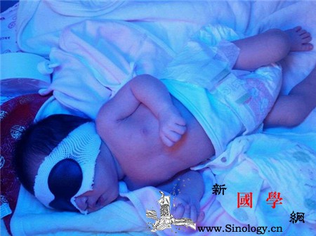 新生儿黄疸照蓝光费用是多少_胆红素-红细胞-黄疸-母乳-