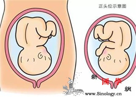 胎儿头位高能顺产吗关于顺产这些知识你必须知_胎位-顺产-胎儿-知晓-