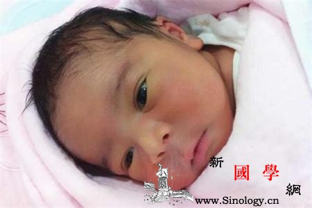 新生儿查黄疸要抽血吗_胆红素-正常值-早产儿-黄疸-