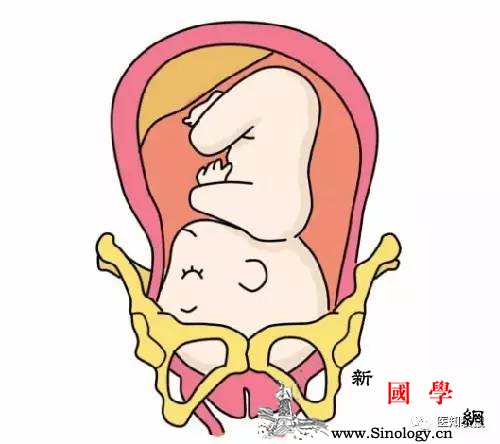 胎儿入盆就是要生了？5大征兆告诉你：胎儿入盆_顺产-骨盆-分娩-胎儿-