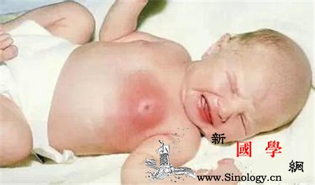新生儿乳头要不要挤_催乳素-肿胀-乳头-红肿-