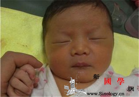 新生儿黄疸能打预防针吗_胆红素-黄疸-预防针-接种- ()