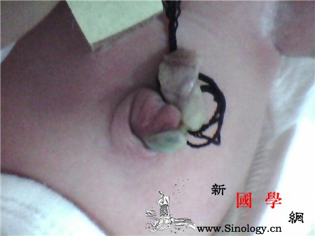 新生儿脐带出血怎么办_棉签-脐带-涂抹-动脉-