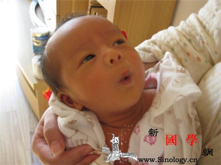 母乳性黄疸能打乙肝疫苗吗_糖醛酸-胆红素-黄疸-母乳-