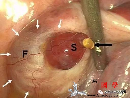 女人排卵过程全程实拍！这时造人一发就中！_卵泡-卵子-受精-排卵-怀孕准备