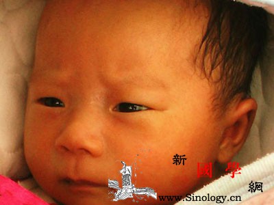 溶血性黄疸多久能好_胆红素-溶血-黄疸-换血-