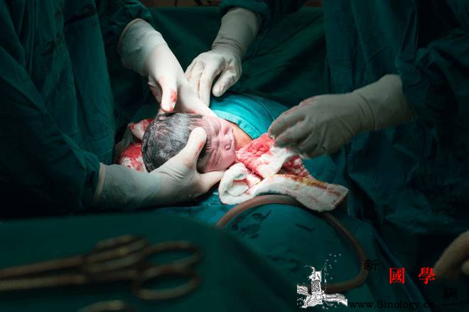 因为剖腹产她成了痴呆！剖腹产竟然这么危险！_产道-顺产-剖腹产-分娩-