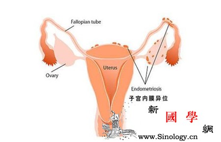 子宫内膜增厚的原因子宫内膜增厚可能是肿瘤吗_雌激素-痛经-持续性-肿瘤-怀孕准备