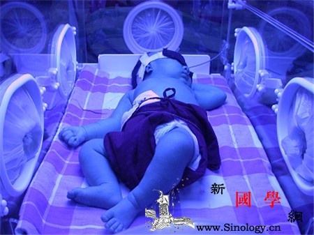 新生儿照蓝光一次多久_光疗-胆红素-红细胞-黄疸-