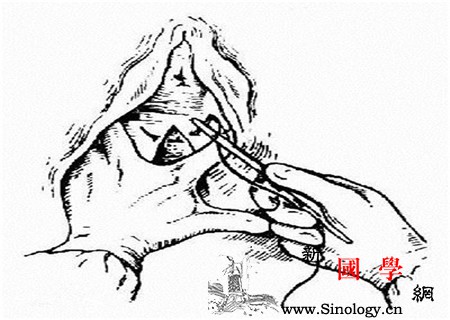 生宝宝为什么要会阴侧切侧切恢复方法在这_助产-顺产-会阴-分娩-