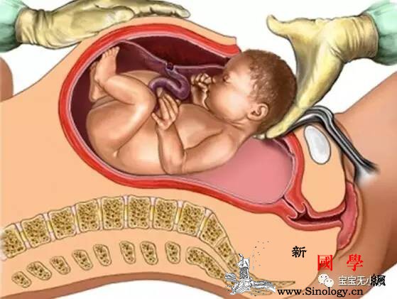 剖腹产你是等宝宝发动还是挑日子剖呢？这位妈_顺产-剖腹产-日子-宝宝-