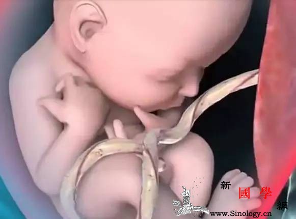 调皮女宝宝把脐带缠绕了5个圈圈脐带缠绕是不_胎动-脐带-剖腹产-胎儿-