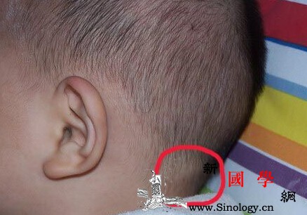宝宝耳朵后长淋巴结怎么办有什么办法消除_淋巴结-肿大-消除-耳朵-