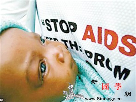 新生儿艾滋病能活多久_艾滋病毒-艾滋病-婴儿-感染-