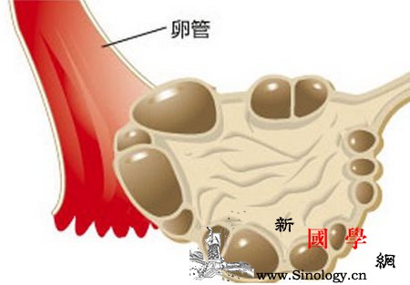 患了多囊卵巢综合征该怎么办？_月经-生育-症状-患者-不孕不育