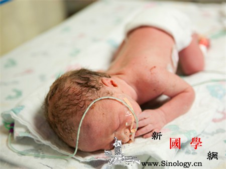 早产儿脑损伤能治好吗_早产儿-胎盘-缺氧-治好-