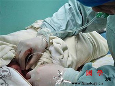 新生儿吸入胎粪严重吗_胎动-羊水-黄绿色-产前-