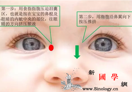 新生儿泪道堵塞怎么办_泪液-角膜炎-眼药水-阻塞-