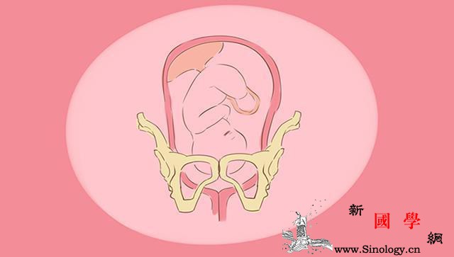 胎儿入盆有什么感觉？入盆后立刻就会生吗？_感觉到-胎儿-子宫-压迫-
