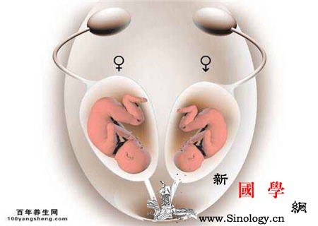 双子宫对怀孕有影响吗多个子宫更好吗_受孕-胎儿-子宫-怀孕-