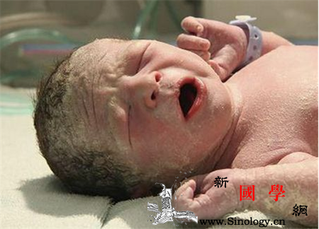 胎脂可以涂麻油软化吗麻油、橄榄油、润肤油皆_脱脂棉-麻油-橄榄油-软化-