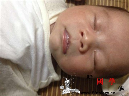 新生儿肺炎一定要住院吗要做哪些检查呢_乳汁-肺炎-吸入-感染-