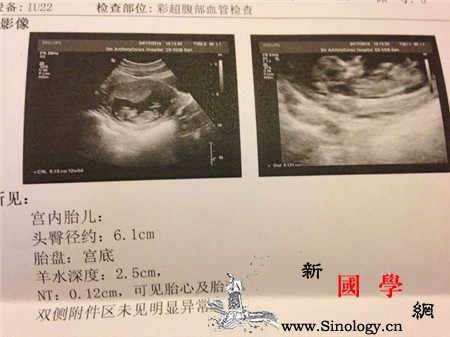 怎样从b超单上看男孩女孩超准辨别胎儿性别的_生下-上看-辨别-男孩-生男生女