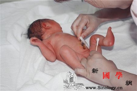 脐带脱落后出血怎么办别慌少许渗血属正常_脐带-尿液-肚脐-渗出-