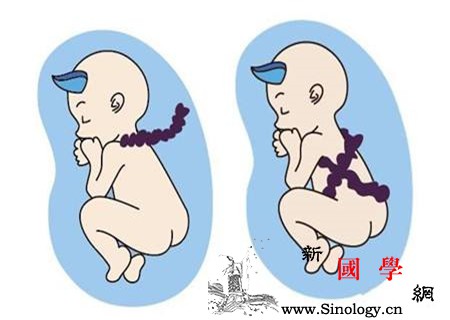 脐带扭转发生在几周你不知道的孕期小事件_胎动-脐带-孕期-胎儿-