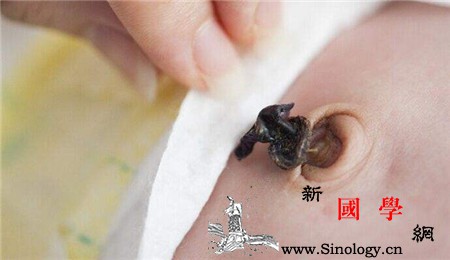 如何预防新生儿脐炎防大于治_会有-产前-根部-脱落-
