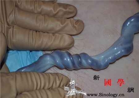 脐带扭转跟基因有关吗带你了解脐带扭转的真正_脐带-病因-胎儿-扭转-