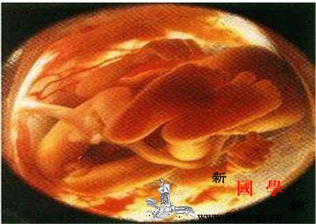 羊水少对胎儿的影响有哪些这些危害要晓得_羊水-胎儿-畸形-斜颈-