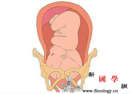 初产妇什么时候入盆胎儿入盆时间需知晓_初产妇-临产-骨盆-什么时候-