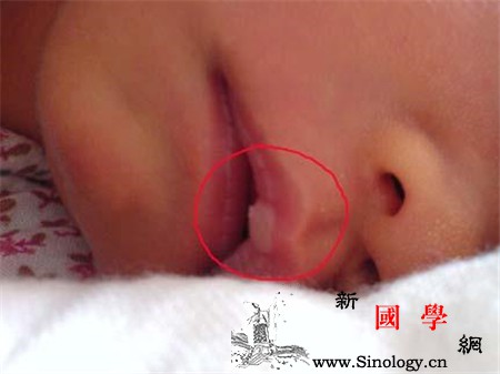 新生儿嘴上有白泡是怎么回事是正常的！_口唇-吸吮-娇嫩-嘴上-