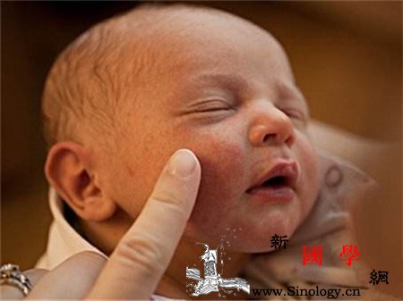 母乳性黄疸停母乳几天能看出效果日常护理要怎_胆红素-黄疸-几天-血清-