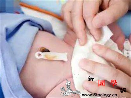脐带没掉可以穿纸尿裤吗要注意什么_脐带-纱布-臀部-脱落-