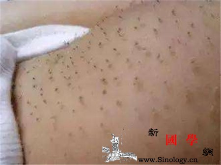 猪毛风搓起来后怎么办_棉球-棉线-用手-梳子-