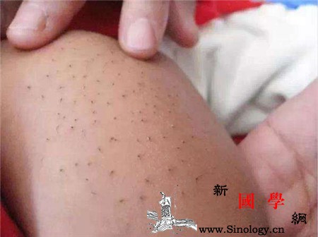新生儿猪毛风是什么_蛋清-汗毛-擦拭-观点-