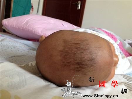 新生儿头型怎么睡好看注意这4点就能有好头型_囟门-头型-闭合-枕头-