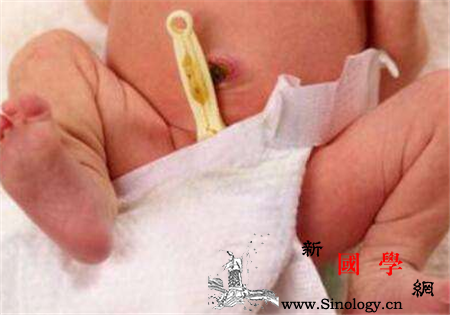新生儿什么时候剪脐带最好_什么时候-脐带-或者是-出生-