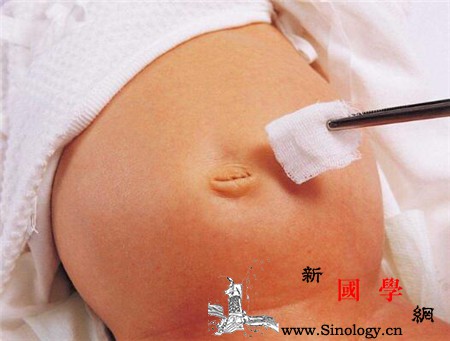 新生儿肚脐出血是什么原因_肉芽肿-会有-脐带-分泌物-