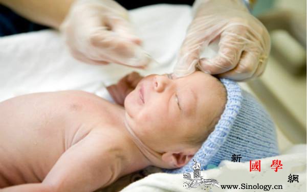新生儿宝宝眼屎多的原因护理措施有哪些_眼屎-眼睫毛-护理-措施-