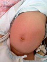 新生儿肚子起红点怎么回事解决方法是什么_疮痂-皮疹-水痘-荨麻疹-