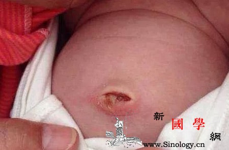 照顾新生婴儿这几个地方不能随便动！_肚脐-囟门-宝宝-乳房-