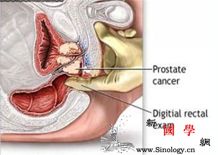 外阴伤口缝针能碰水吗基础护理要做好_缝针-拆线-会阴-外阴-