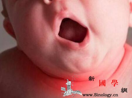 新生儿喉喘鸣的原因_声门-呼气-吸气-狭窄-